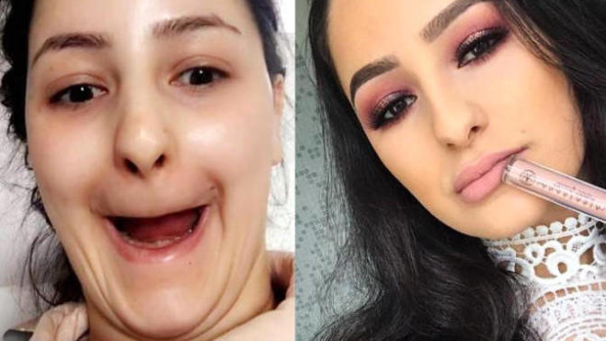 Sevdiğiniz Kadını Bahçe Hortumuyla Yıkamanız Gerektiğini Gösteren 8 Fotoğraf!