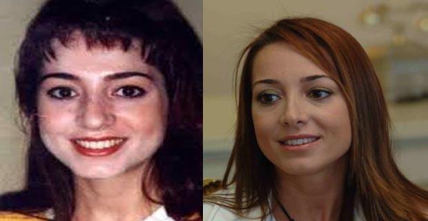 İki Resim Arasındaki 7 Farkı Bulun! Ünlülerimizin Estetikli Halleri