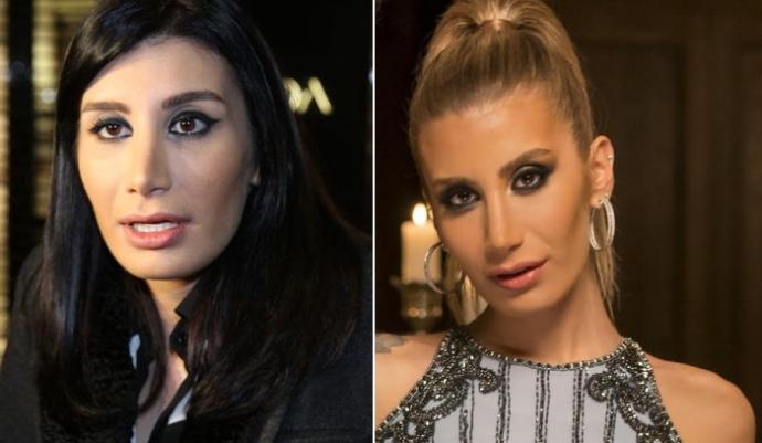 İki Resim Arasındaki 7 Farkı Bulun! Ünlülerimizin Estetikli Halleri