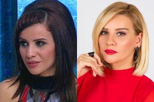 İki Resim Arasındaki 7 Farkı Bulun! Ünlülerimizin Estetikli Halleri