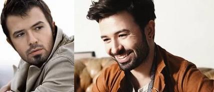 "Kelin Merhemi Olsa Kendi Başına Sürermiş" Sözünü Kanıtlayarak Saç Ektiren Ünlülerimiz