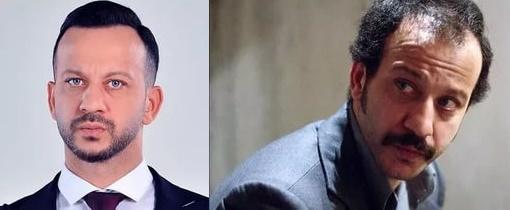 "Kelin Merhemi Olsa Kendi Başına Sürermiş" Sözünü Kanıtlayarak Saç Ektiren Ünlülerimiz