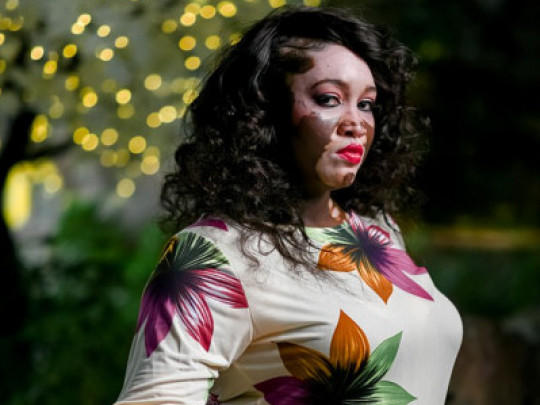 Kusurların Hiçbir Şeye Engel Olmadığını Gösteren Model ve Büyükanne Iomikoe Johnson ile Tanışın!