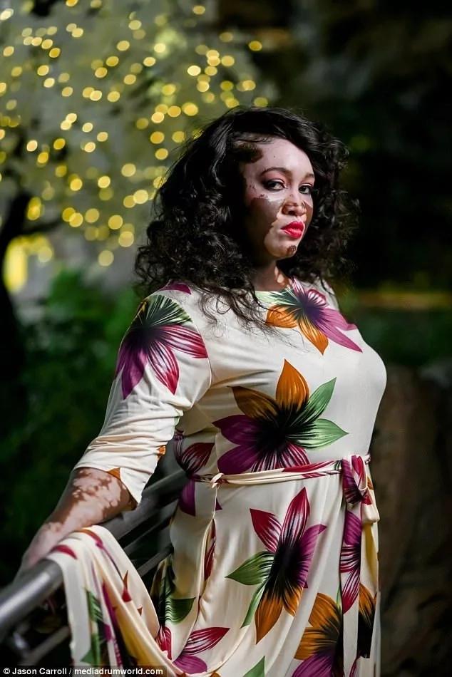 Kusurların Hiçbir Şeye Engel Olmadığını Gösteren Model ve Büyükanne Iomikoe Johnson ile Tanışın!