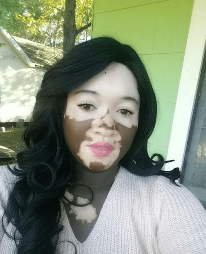 Kusurların Hiçbir Şeye Engel Olmadığını Gösteren Model ve Büyükanne Iomikoe Johnson ile Tanışın!