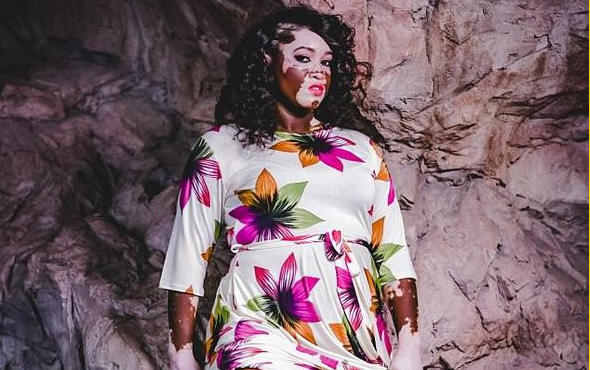 Kusurların Hiçbir Şeye Engel Olmadığını Gösteren Model ve Büyükanne Iomikoe Johnson ile Tanışın!