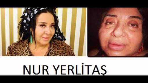 Türk Ünlülerin Hiç Görmediğiniz, Görünce Sizi Şok Edecek Fotoğraf Kareleri!