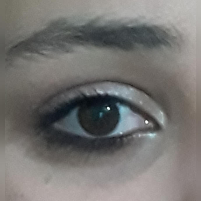 Bu goz sekli badem mi oluyor?