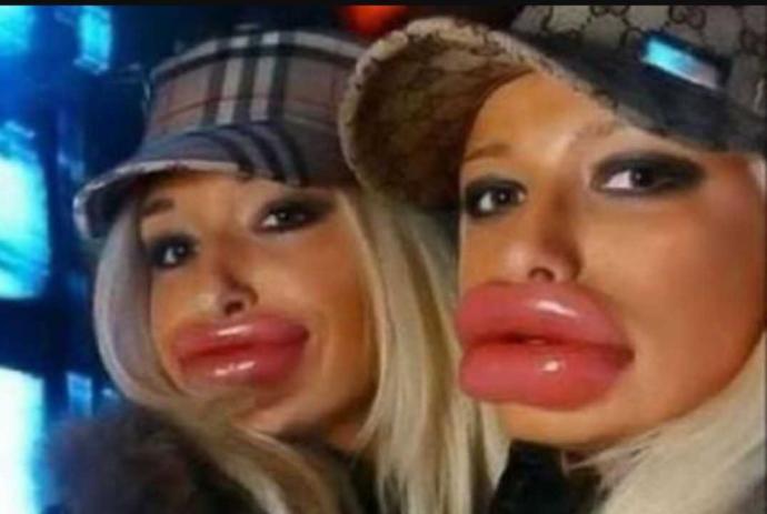 Dolgun dudaklar mı, keskin yüz hatları mı daha öndedir sizce?