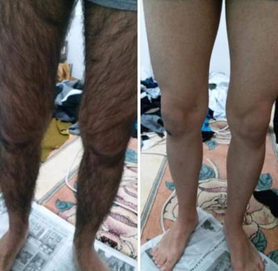 Bir erkek bacak kıllarını almalı mı?