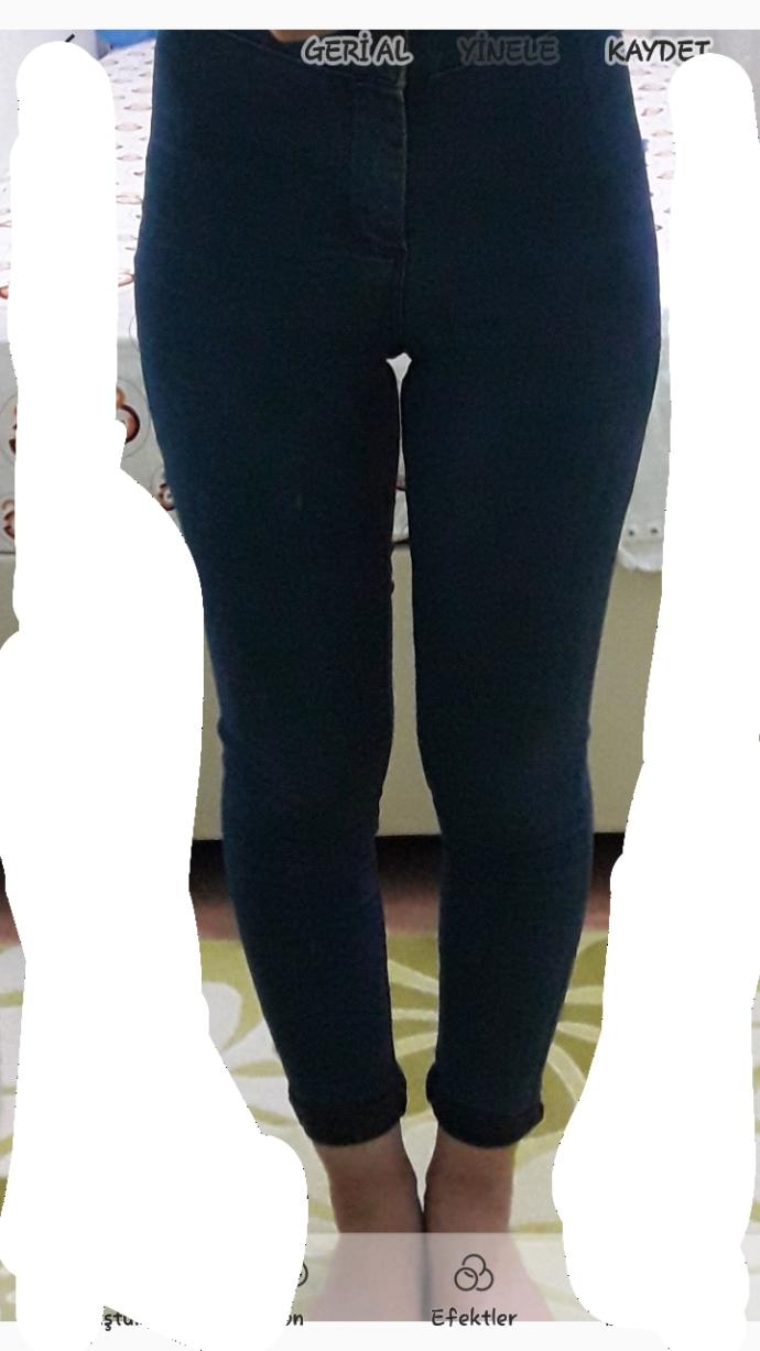 Bacaklarim çap mi duruyo? Bana oyle gibi geldi sizcede çap mi? Ameliyat olmali miyim?