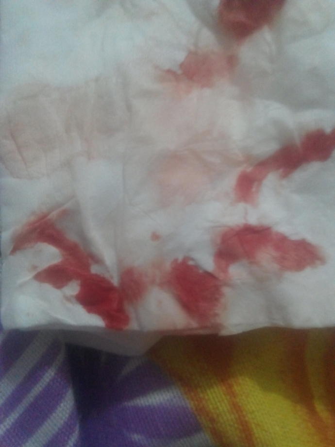 Kan rengim hangi renk tonunda?