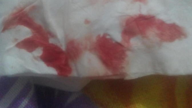 Kan rengim hangi renk tonunda?