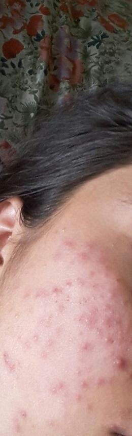 Kullandıktan sonra bu hale geldi