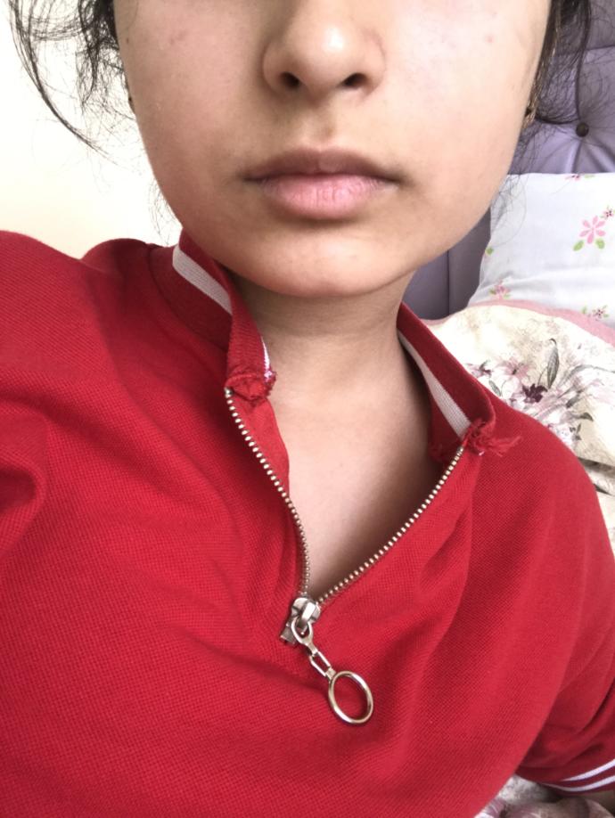 Sizce dudak dolgusu yaptırmalımıyım?