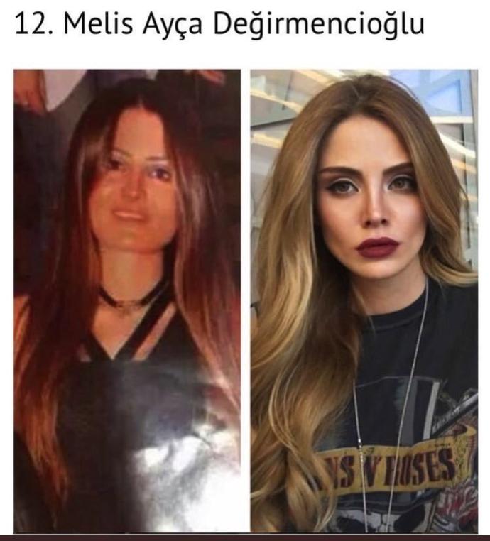 Olaydan sonra özellikle kızlar tarafından Loris'e gönderilen o meşhur fotoğraf sdjskdkfkdkdkd