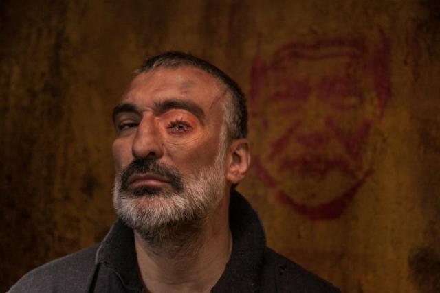 Kurtlar Vadisi Hastaları burda mı?