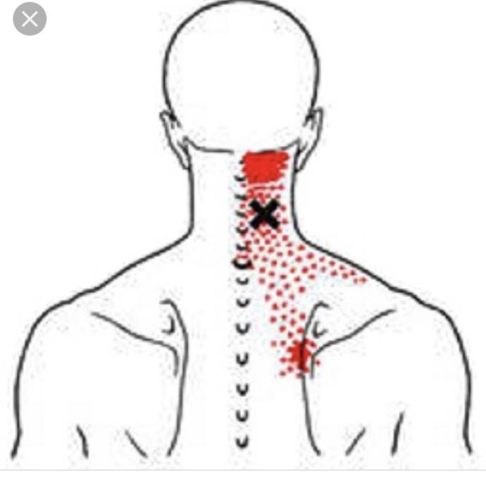 Birileri boynumu belimi cigneyebilirmi lutfen🤕😪?
