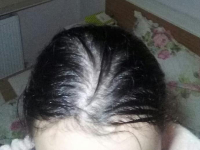 Işığın tam altında çekince nasıl çıktı yaa resmen kel gibi:'(
