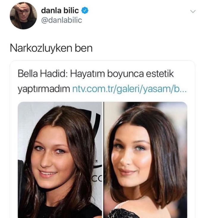 Bazı ünlüler güzellik uğruna estetik yaptırdıklarını, neden saklıyorlar?