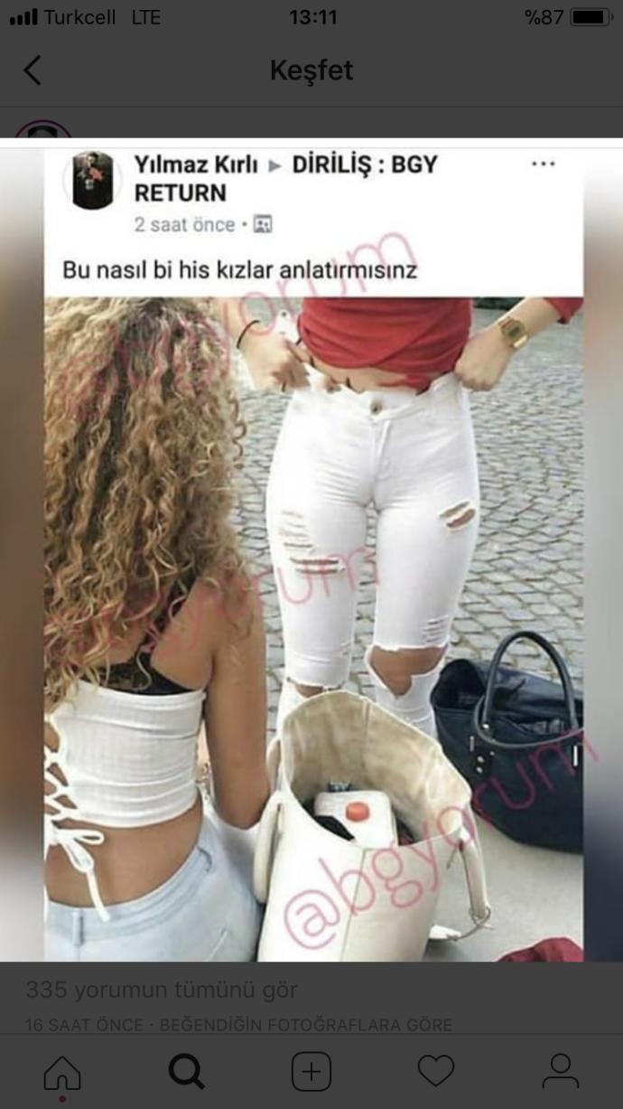 Acıyor mu hiç 😕😕😕😯
