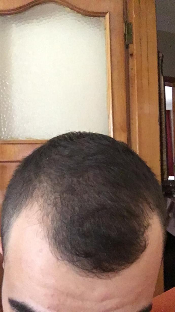Sizce kel kalır mıyım?