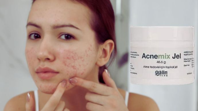 Acnemix Yüzde Kızarıklık Yapar Mı?