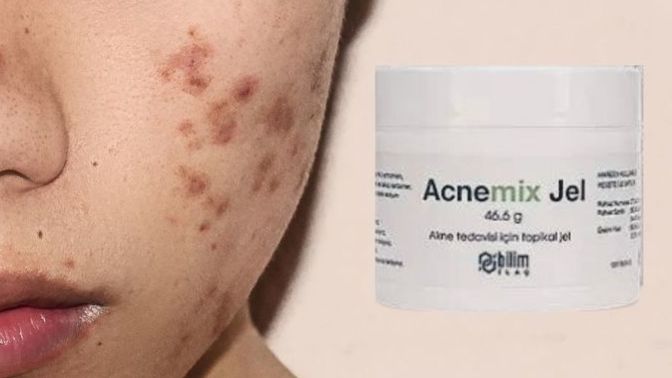 Acnemix jel yüzümü yaktı ne yapmalıyım?
