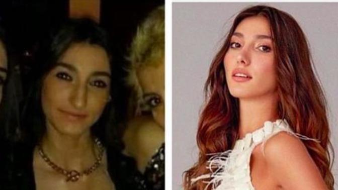 Miss Turkey 2018 güzeli Şevval Şahin "estetik harikası" olduğu ortaya çıktı. Tacı geri alınmalı mı?