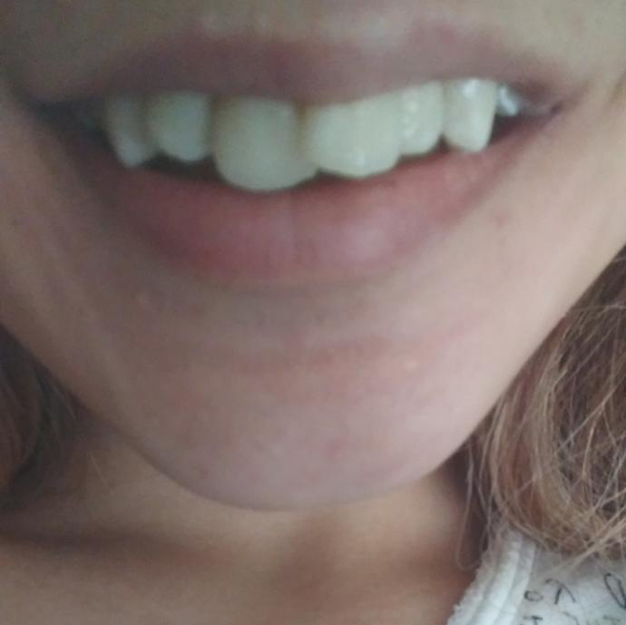 Dişlerim çokmu yamuk, itici mi duruyo😑?