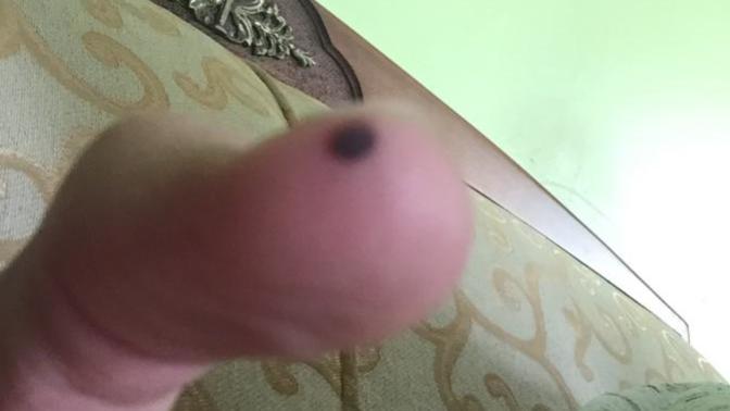 Baş parmak yarası?