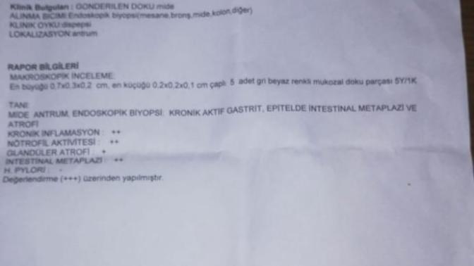 Arkadaşlar anlayan var mı?