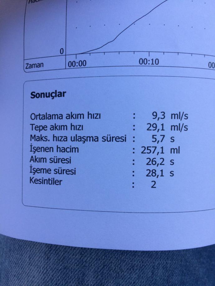 Arkadaşlar iseme hiz testi yaptirdim bugun degerler nasil anlayan birileri varsa yorum yapabilir mi?