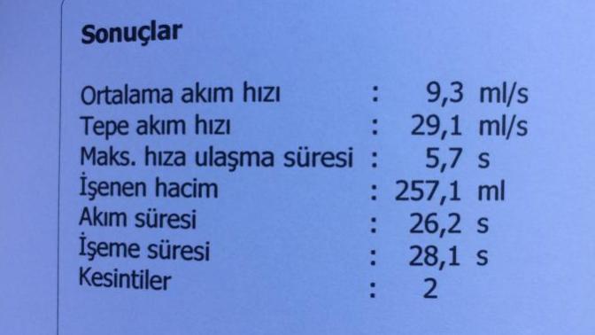 Arkadaşlar iseme hiz testi yaptirdim bugun degerler nasil anlayan birileri varsa yorum yapabilir mi?
