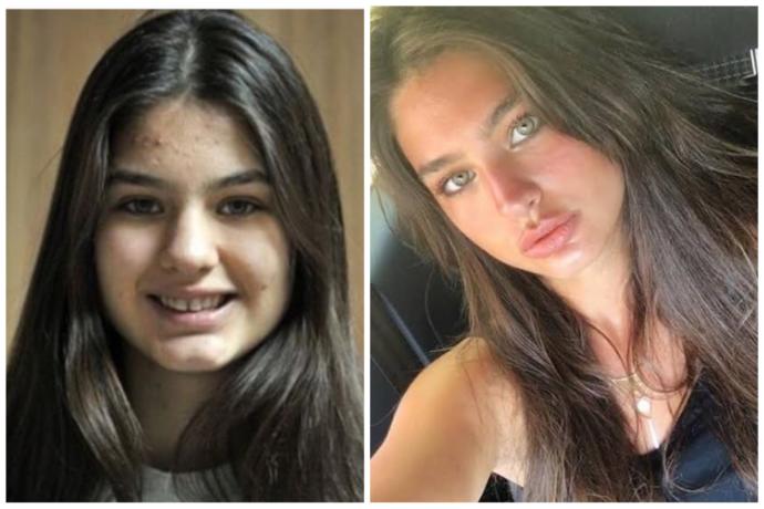 Karşınızda 2015 Miss Turkey Ecem Çırpan! Güzel değilim demeyin estetik parası biriktirin işi bitirin. Haksız mıyım?