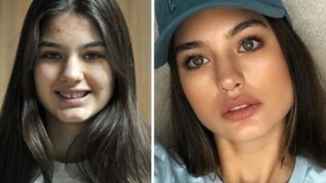 Karşınızda 2015 Miss Turkey Ecem Çırpan! Güzel değilim demeyin estetik parası biriktirin işi bitirin. Haksız mıyım?