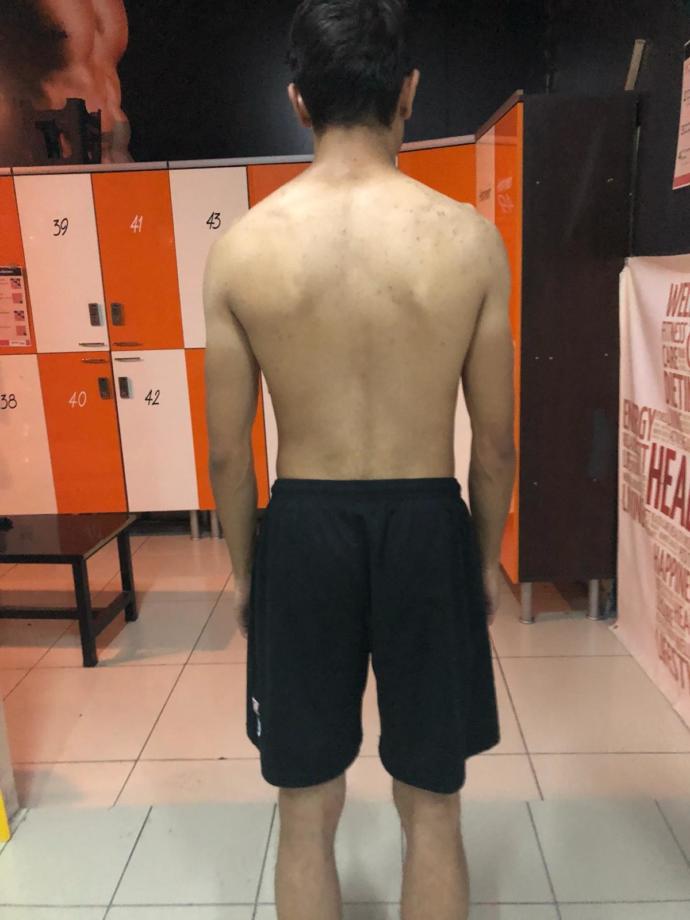 Boy 1.77. Omuz 108 cm normal mi sizce?