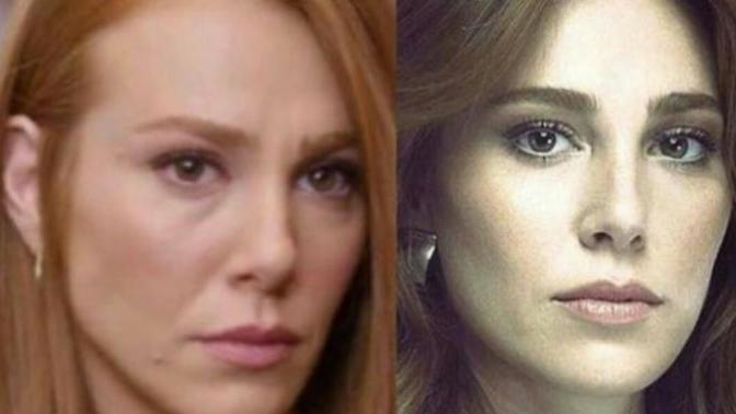Sizce Elçin Sangu'nun yüzünde estetik var mı?