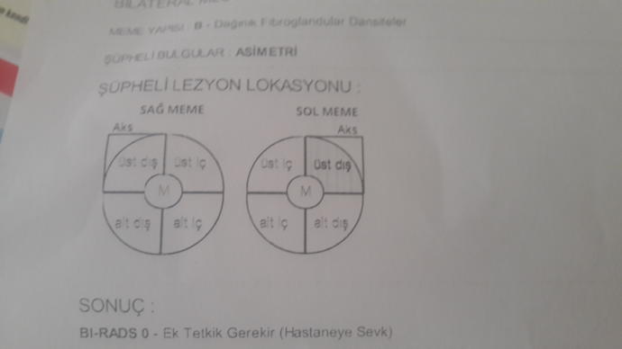 Sonuç kısmı ne demek istiyor bilen arkadaşlar varsa sevinirim.