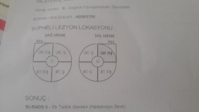 Mamografi sonucu?