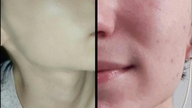 Kızlar, Korelilerin "Glass-Skin" trendini denedim sizce nasıl olmuş?