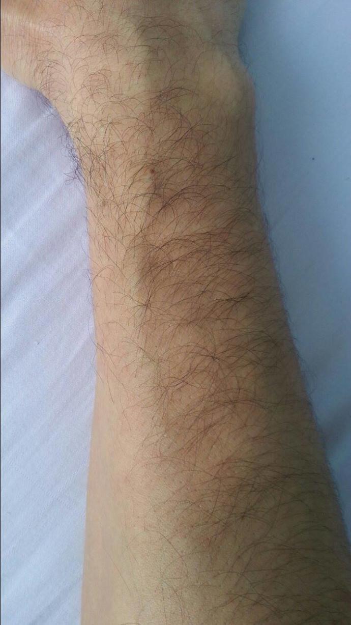 Arkadaşlar bulk dönemi için tavsiye verirmisiniz?