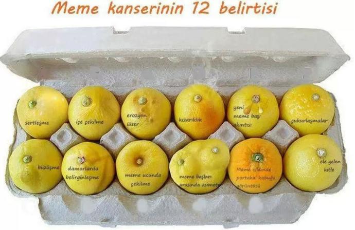 Kendi kendine meme kontrolü yapılabilir mi?