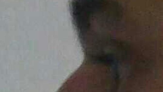 Burnum Yandan Bakinca Cok Cirkin?
