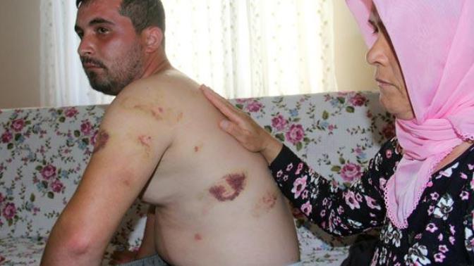 Korkunç olay! Erkeğe işkence yapan, bıçaklayan, vücudunda sigara söndüren kadın serbest bırakıldı. Akp neden feministlik yapıyor?