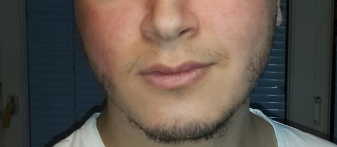 Resimlere göre yağ oranım fazla, düşürürsem egzersizle köşeli çene hattı ve erkeksi keskin yüz hatlarına sahip olmam mümkün mü?