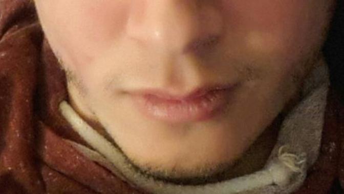 Resimlere göre yağ oranım fazla, düşürürsem egzersizle köşeli çene hattı ve erkeksi keskin yüz hatlarına sahip olmam mümkün mü?