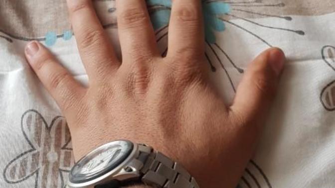 Herkes ellerimin küçük olduğunu söylüyor ellerim 1.50 boyundaki kızın ellerinden bile küçük?