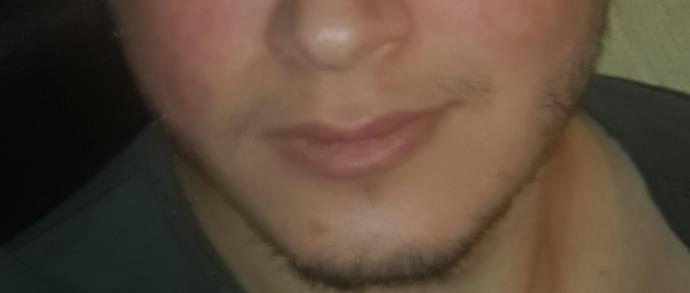 Yüz hatlarım keskin mi sizce yağ oranı düşse keskin olabilir mi?