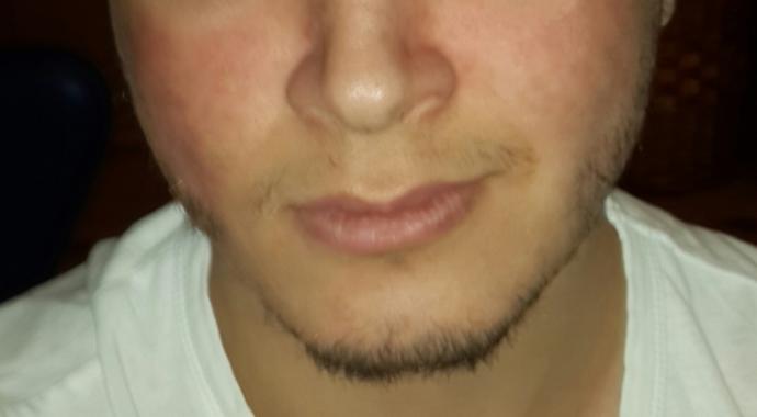 Yüz hatlarım keskin mi sizce yağ oranı düşse keskin olabilir mi?